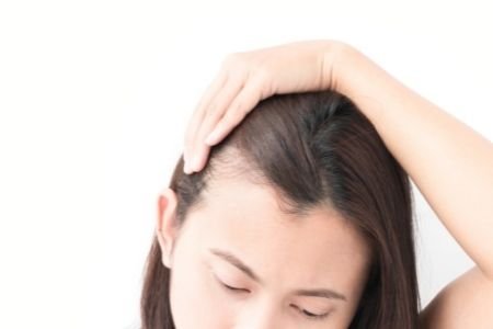 La tricotillomania è lo stimolo irrefrenabile di strapparsi i capelli